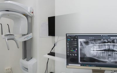 Radiología digital vs radiografía convencional