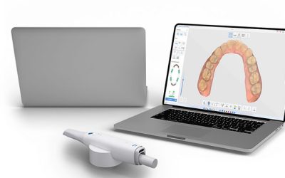 Tecnología Avanzada en la Clínica Dental Special Dent: El Escáner Oral Medit i600