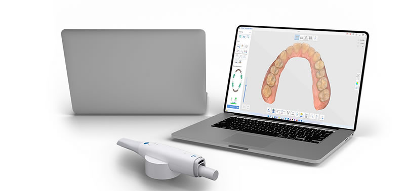 Tecnología Avanzada en la Clínica Dental Special Dent: El Escáner Oral Medit i600