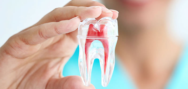 ¿Qué es la endodoncia y cuáles son sus pasos?