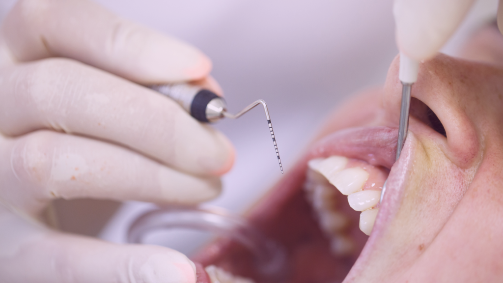 periodoncia
