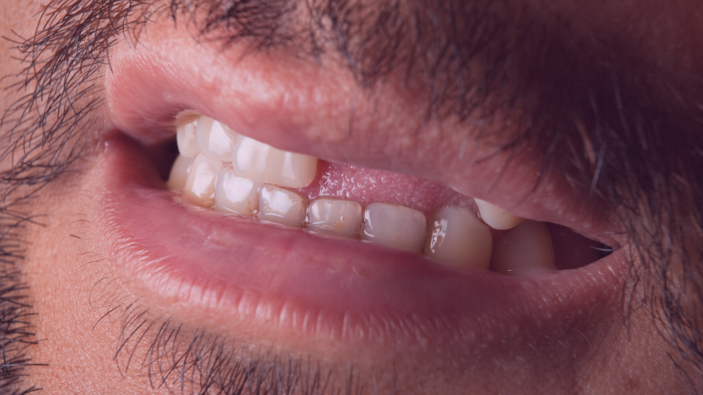 rehabilitacion dental